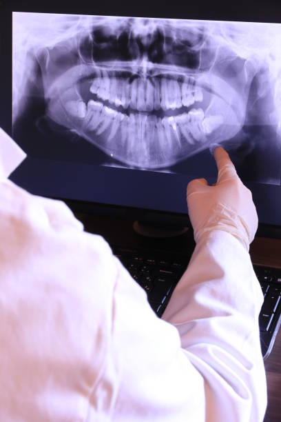 Best Knocked-Out Tooth Emergency  in Lockport Heights, IL