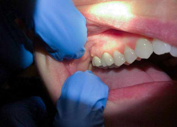 Best Teeth Whitening  in Lockport Heights, IL