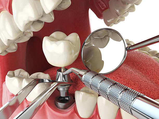 Best Urgent Tooth Repair  in Lockport Heights, IL