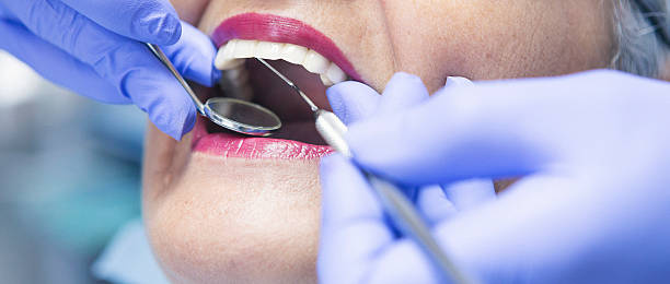 Best Knocked-Out Tooth Emergency  in Lockport Heights, IL